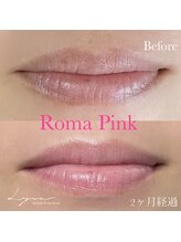 リラ(Lyra)/ローマピンクリップ