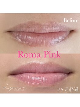 リラ(Lyra)/ローマピンクリップ