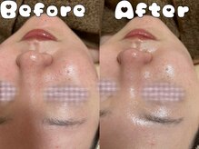 グラシア 倉敷店(Gracia)/お客様の施術事例