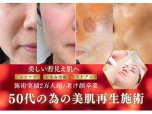 グラチア(Gratiae)