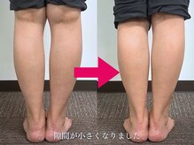 【つぼの奴隷】足つぼ整体専門店【6月28日 NEW OPEN（予定）】/O脚調整★自信を持って脚出せる!
