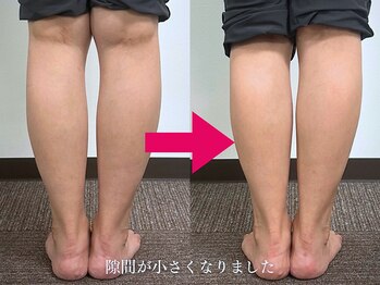 【つぼの奴隷】足つぼ整体専門店【6月28日 NEW OPEN（予定）】/O脚調整★自信を持って脚出せる!