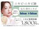 ビズビズ 天王寺店(bisebise)の写真