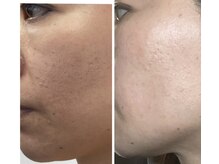 プラチナアース つくば店(Platinum earth)/リアボーテ・ビフォーアフター