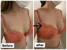 プレフィール(PLEAFEEL)/