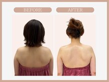 スリムライン 盛岡店(The Slim Line)/before→after