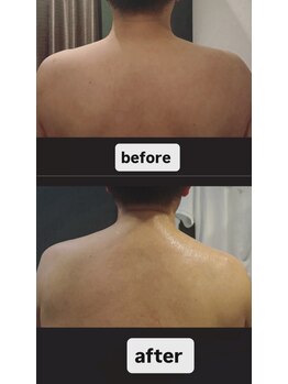 ディベス 仙台卸町本店(DIVES)/施術