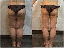 美容整体ウェリナ 名駅院/小顔矯正/骨盤矯正/痩身整体