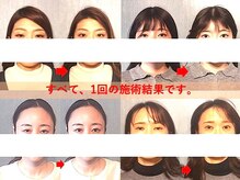 アトラスの雰囲気(骨格から整えて、リフトアップ&ぱっちり目◎で理想のわたしへ。)