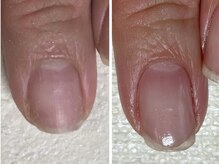 カランコエ(Kalanchoe)/地爪育成