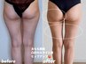  【夏限定★ドームサウナ付き】感動ヒップアップ×太ももスッキリ体験 &nbsp;