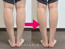 【つぼの奴隷】足つぼ整体専門店【6月28日 NEW OPEN（予定）】/むくみ撲滅★自信持って脚出せる