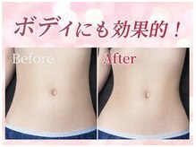 リフト 門前仲町(Lift)/小顔専門店Lift｜痩身施術