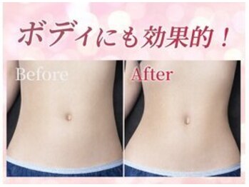 リフト 門前仲町(Lift)/小顔専門店Lift|痩身施術