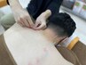 【ガンコすぎるコリには！】全身マッサージ＋鍼灸　￥9,900 計60分