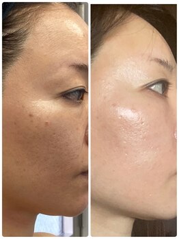 プラチナアース つくば店(Platinum earth)/リアボーテ・ビフォーアフター