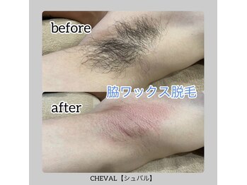 シュバル(CHEVAL)/脇ワックス脱毛！
