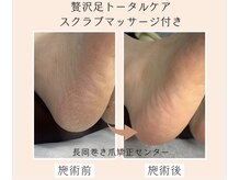 長岡巻き爪矯正センター