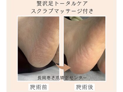 長岡巻き爪矯正センターの写真