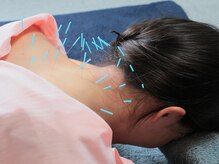 旭堂/【学割U24】全身鍼灸60分￥4,000