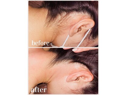 フリルスタイル(FRILL STYLE)の写真