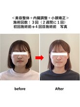 ぷめはな整体/美容整体+小顔矯正