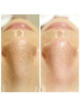 アイ アンド ネイル(Eye＆Nail Day)/洗浄×ヒト幹細胞×エクソソーム