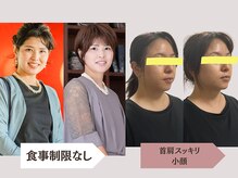 サリー(Sally)の雰囲気（小顔・たるみ◎骨格が整えば見た目も変わる◎）