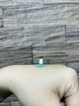 わきさか鍼灸整骨院・鍼灸院 レーヴ(Reve)/温かく、気持ちいいお灸♪