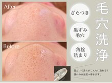 レイジア デイスパ 浜松(Day Spa)の雰囲気（憧れの水光肌になれる！毛穴洗浄 初回50％オフ！）