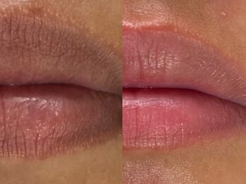 フェリス(FELIZ)/口紅要らずで明るい印象に