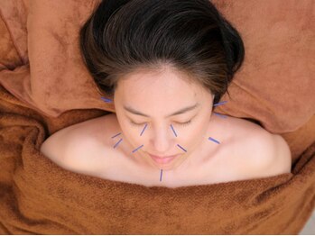 ネージュ鍼灸院(neige鍼灸院)の写真/【鍼灸デビューの方におすすめ】お肌・全身のお悩みを解決◎痛みが少ない優しい鍼でリラックスできる90分!