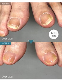 BEFORE/AFTER　メンズ大歓迎！