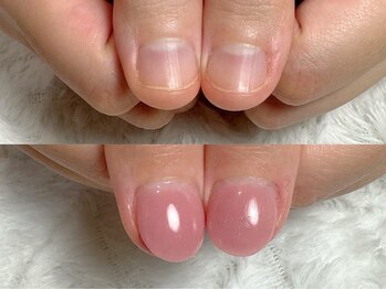 グレースレディ/長年のお悩み解決しましょう