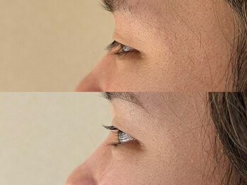 ルネア(Lunea)/メンズまつげパーマ