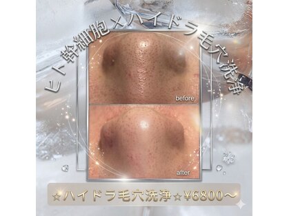 エンチャント(ENCHANT)の写真