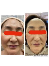 オリーブ(Olive)/