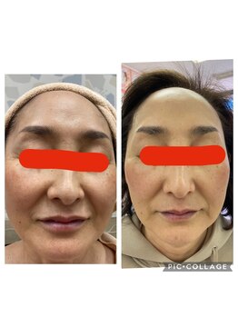 オリーブ(Olive)/