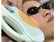 ブリジェビューティーサポート(Brije Beauty Support)の写真/人気！【隠す肌から魅せる肌へ】シミ、くすみ、毛穴をまとめてケア☆ダウンタイムもなく肌全体を底上げ♪