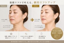 トータルビューティサロン クイーン(Queen)