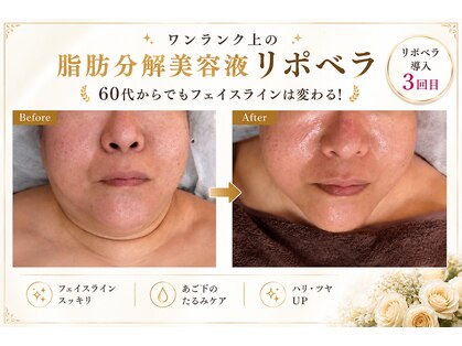 ハピネス(Hapiness)の写真