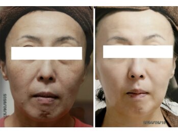 メディカルサロン かとれあの写真/迷われてる方はこちら[あなただけの完全オーダーメイド]