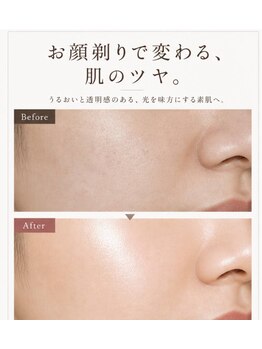 ソル(SOL)の写真/肌がキレイに見える人は、産毛まで整えている。顔そりでハリ・ツヤまで映える素肌と清潔感♪/シェービング