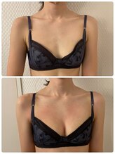 プレフィール(PLEAFEEL)/