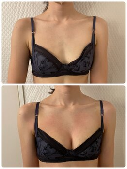 プレフィール(PLEAFEEL)/