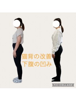 フォーシー(4C)/Before/After