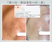 フォーチューン