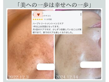 フォーチューン