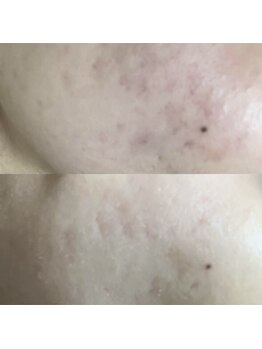 ヴェルシック(Belchic)/2種類の国産ハーブを駆使