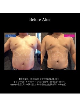 ヴェリー(VARY)/痩身ビフォーアフター